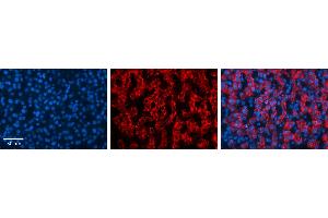 MAP2K3 antibody - C-terminal region          Formalin Fixed Paraffin Embedded Tissue:  Human Liver Tissue    Observed Staining:  Cytoplasm in hepatocytes   Primary Antibody Concentration:  1:100    Other Working Concentrations:  1/600    Secondary Antibody:  Donkey anti-Rabbit-Cy3    Secondary Antibody Concentration:  1:200    Magnification:  20X    Exposure Time:  0. (MAP2K3 Antikörper  (C-Term))