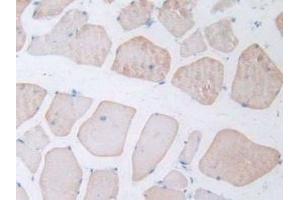 Immunohistochemistry (IHC) image for anti-Pro-Atrial Natriuretic Peptide (PRO-ANP) (AA 25-122) antibody (ABIN7445447)