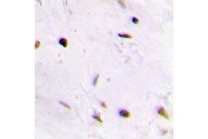 Immunohistochemical analysis of QDPR staining in human brain formalin fixed paraffin embedded tissue section.