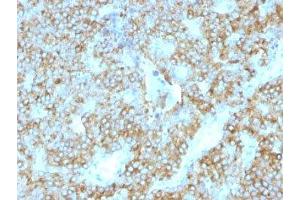 Formalin-fixed, paraffin-embedded human parathyroid stained with PTH antibody (PTH/1175). (PTH Antikörper  (AA 32-115))
