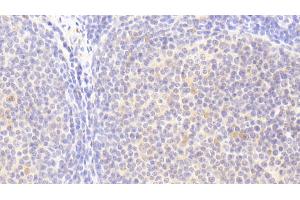 Immunohistochemistry (IHC) image for anti-Hemopoietic Cell Kinase (HCK) (AA 2-526) antibody (ABIN7443947)