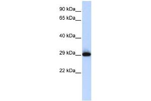 SUSD3 antibody used at 1 ug/ml to detect target protein. (SUSD3 Antikörper  (N-Term))