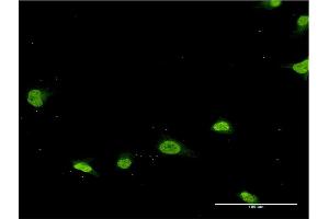 Immunofluorescence of monoclonal antibody to PSMB8 on HeLa cell. (PSMB8 Antikörper  (AA 173-272))