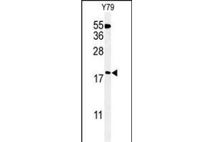Western blot analysis of TXNDC12 Antibody (C-term) (ABIN651065 and ABIN2840056) in Y79 cell line lysates (35 μg/lane).