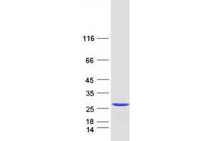 Validation with Western Blot