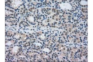 Immunohistochemical staining of paraffin-embedded Ovary tissue using anti-STK39mouse monoclonal antibody. (STK39 Antikörper)