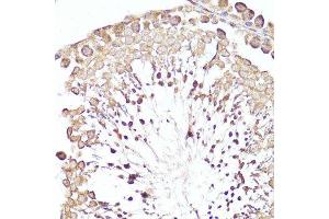 Immunohistochemistry (Paraffin-embedded Sections) (IHC (p)) image for anti-Membrane Metallo-Endopeptidase (MME) (AA 52-352) antibody (ABIN6143900)