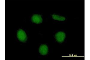 Immunofluorescence of purified MaxPab antibody to NET1 on HeLa cell.