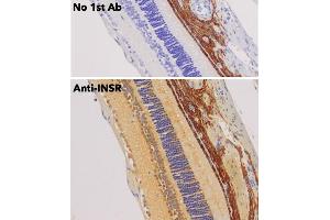 Immunohistochemistry (IHC) image for anti-Insulin Receptor (INSR) (C-Term) antibody (ABIN6254165)