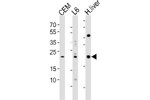 Western blot analysis of lysates from CEM, rat L6 cell line and human liver tissue lysate(from left to right), using PEMT Antibody (N-term) (ABIN650614 and ABIN2844055). (PEMT Antikörper  (N-Term))