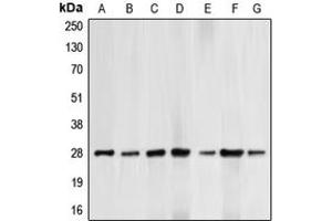 Western blot analysis of BCL2 (pT69) expression in HepG2 UV-treated (A), HeLa (B), HL60 (C), THP1 (D), Jurkat paclitaxel-treated (E), NIH3T3 H2O2-treated (F), PC12 H2O2-treated (G) whole cell lysates. (Bcl-2 Antikörper  (pSer69))