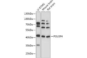 Western blot analysis of extracts of various cell lines, using POU3F4 antibody (ABIN7269496) at 1:1000 dilution. (POU3F4 Antikörper  (AA 1-190))