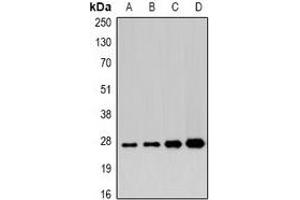 Western blot analysis of APIP expression in 22RV1 (A), mouse heart (B), mouse liver (C), rat stomach (D) whole cell lysates. (APIP Antikörper)