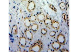Immunohistochemistry (IHC) image for anti-Cadherin 1, Type 1, E-Cadherin (Epithelial) (CDH1) (AA 373-621) antibody (ABIN7430405)