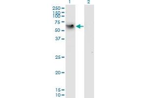 Western Blot analysis of CD44 expression in transfected 293T cell line by CD44 monoclonal antibody (M05), clone 2H5. (CD44 Antikörper  (AA 1-699))
