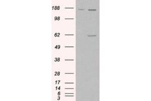 Western Blotting (WB) image for anti-Monoamine Oxidase A (MAOA) (Internal Region) antibody (ABIN2465953) (Monoamine Oxidase A Antikörper  (Internal Region))