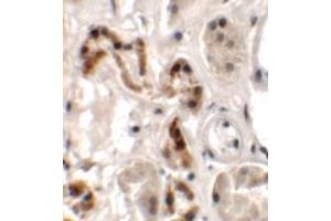 Immunohistochemistry of DBX1 in human kidney tissue with DBX1 antibody at 2. (DBX1 Antikörper  (Middle Region))