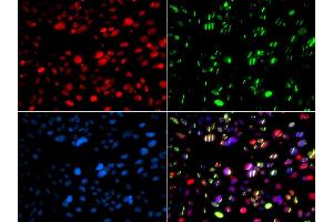 Immunofluorescence analysis of GFP-RNF168 transgenic U2OS cells using PNKP antibody. (PNKP Antikörper  (AA 60-320))
