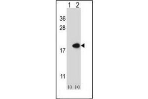 Western blot analysis of FABP2 (arrow) using FABP2 Antibody (N-term) Cat. (FABP2 Antikörper  (N-Term))