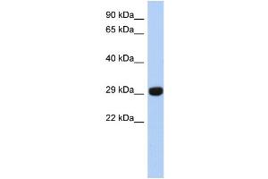 WB Suggested Anti-FN3KRP Antibody Titration: 0. (FN3KRP Antikörper  (N-Term))