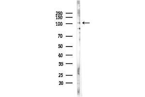 anti-Kinesin Family Member 18A (KIF18A) (Internal Region) antibody