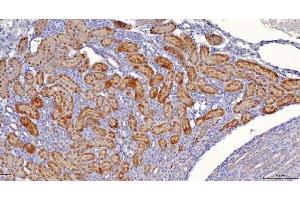 IHC analysis of Sorbitol Dehydrogenase/SORD using anti-Sorbitol Dehydrogenase/SORD antibody (ABIN7602485). (SORD Antikörper  (AA 8-357))