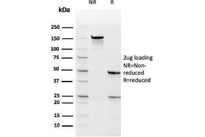 SDS-PAGE Analysis Purified TYMS Recombinant Mouse Monoclonal Antibody (rTYMS/1884).