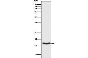 Western blot analysis of Synuclein phosphorylation expression in Human fetal brain lysate.