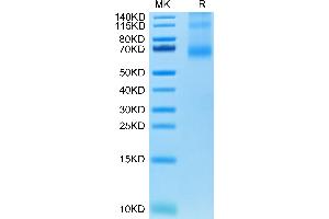 Human OX40 Ligand Trimer on Tris-Bis PAGE under reduced condition. (TNFSF4 Protein (Trimer) (His-DYKDDDDK Tag))
