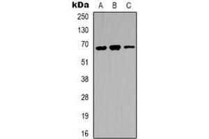 Western blot analysis of IRAK3 expression in LOVO (A), A431 (B), K562 (C) whole cell lysates.
