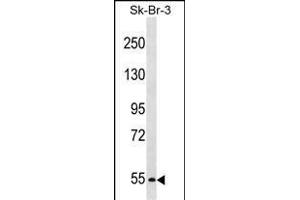 PCSK4 Antibody (N-term) (ABIN1539110 and ABIN2848552) western blot analysis in SK-BR-3 cell line lysates (35 μg/lane). (PCSK4 Antikörper  (N-Term))