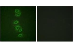 Immunofluorescence analysis of A549 cells, using PP2A-alpha (Phospho-Tyr307) Antibody. (PPP2CA Antikörper  (pTyr307))