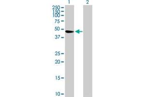 Western Blot analysis of TRIM47 expression in transfected 293T cell line by TRIM47 MaxPab polyclonal antibody. (TRIM47 Antikörper  (AA 1-400))