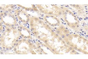 Detection of RBP4 in Human Kidney Tissue using Monoclonal Antibody to Retinol Binding Protein 4 (RBP4) (RBP4 Antikörper  (AA 18-201))