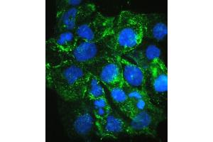 IF analysis of VEGF Receptor 3 using anti-VEGF Receptor 3 antibody (ABIN5693136).