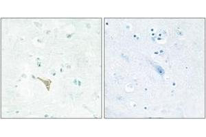 Immunohistochemistry analysis of paraffin-embedded human brain tissue, using RECK Antibody.