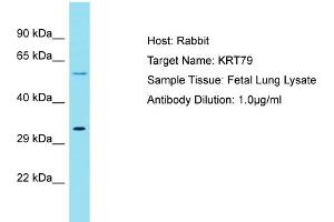 Host: Rabbit Target Name: KRT79 Sample Tissue: Human Fetal Lung Antibody Dilution: 1ug/ml (Cytokeratin 79 Antikörper  (C-Term))