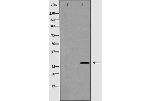 Western blot analysis of Cathepsin G expression in COLO cells,The lane on the left is treated with the antigen-specific peptide. (Cathepsin G Antikörper  (Internal Region))