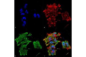 Immunocytochemistry/Immunofluorescence analysis using Mouse Anti-Alpha B Crystallin Monoclonal Antibody, Clone 3A10. (CRYAB Antikörper)