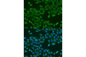 Immunofluorescence analysis of U2OS cells using RPS27A antibody (ABIN1874657) at dilution of 1:100. (RPS27A Antikörper)