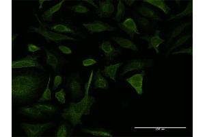 Immunofluorescence (IF) image for anti-Collagen, Type V, alpha 2 (COL5A2) (AA 41-124) antibody (ABIN947720)