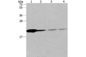 Western Blot analysis of Human fetal liver tissue and 293T cell, Human liver cancer tissue and hela cell using PPIB Polyclonal Antibody at dilution of 1:500 (PPIB Antikörper)