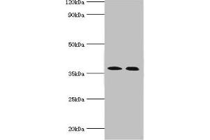 Western blot All lanes: Carbonic anhydrase 14 antibody at 5 μg/mL Lane 1: Mouse liver tissue Lane 2: Jurkat whole cell lysate Secondary Goat polyclonal to rabbit IgG at 1/10000 dilution Predicted band size: 38 kDa Observed band size: 38 kDa (CA14 Antikörper  (AA 16-290))