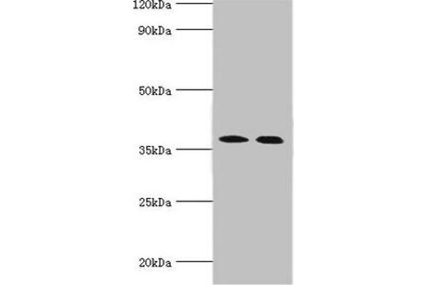 CA14 Antikörper  (AA 16-290)