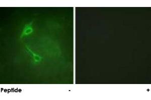 Immunofluorescence analysis of NIH/3T3 cells, using PRKCZ polyclonal antibody . (PKC zeta Antikörper)
