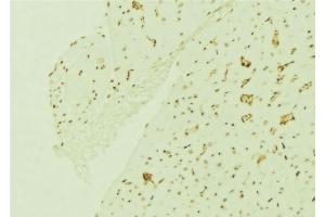 ABIN6276756 at 1/100 staining Mouse brain tissue by IHC-P.