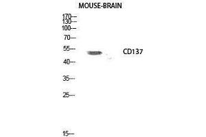 Western Blotting (WB) image for anti-Tumor Necrosis Factor Receptor Superfamily, Member 9 (TNFRSF9) (Internal Region) antibody (ABIN3183733) (CD137 Antikörper  (Internal Region))