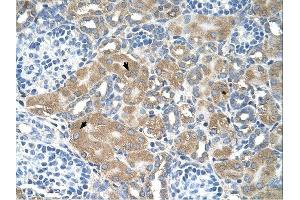 LMAN2 antibody was used for immunohistochemistry at a concentration of 4-8 ug/ml. (LMAN2 Antikörper  (N-Term))