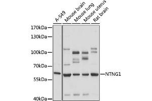 Western blot analysis of extracts of various cell lines, using NTNG1 antibody (ABIN7268853) at 1:1000 dilution. (Netrin G1 Antikörper  (AA 29-300))