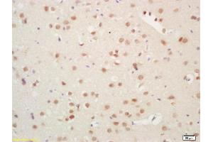 Formalin-fixed and paraffin embedded rat brain labeled with Rabbit Anti Histone H3 Polyclonal Antibody, Unconjugated (ABIN739109) at 1:200 followed by conjugation to the secondary antibody and DAB staining (Histone 3 Antikörper  (AA 71-136))